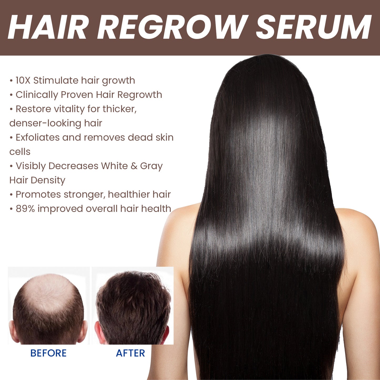 EELHOE Hair Dense Essence: Anti-Hair Loss Solution