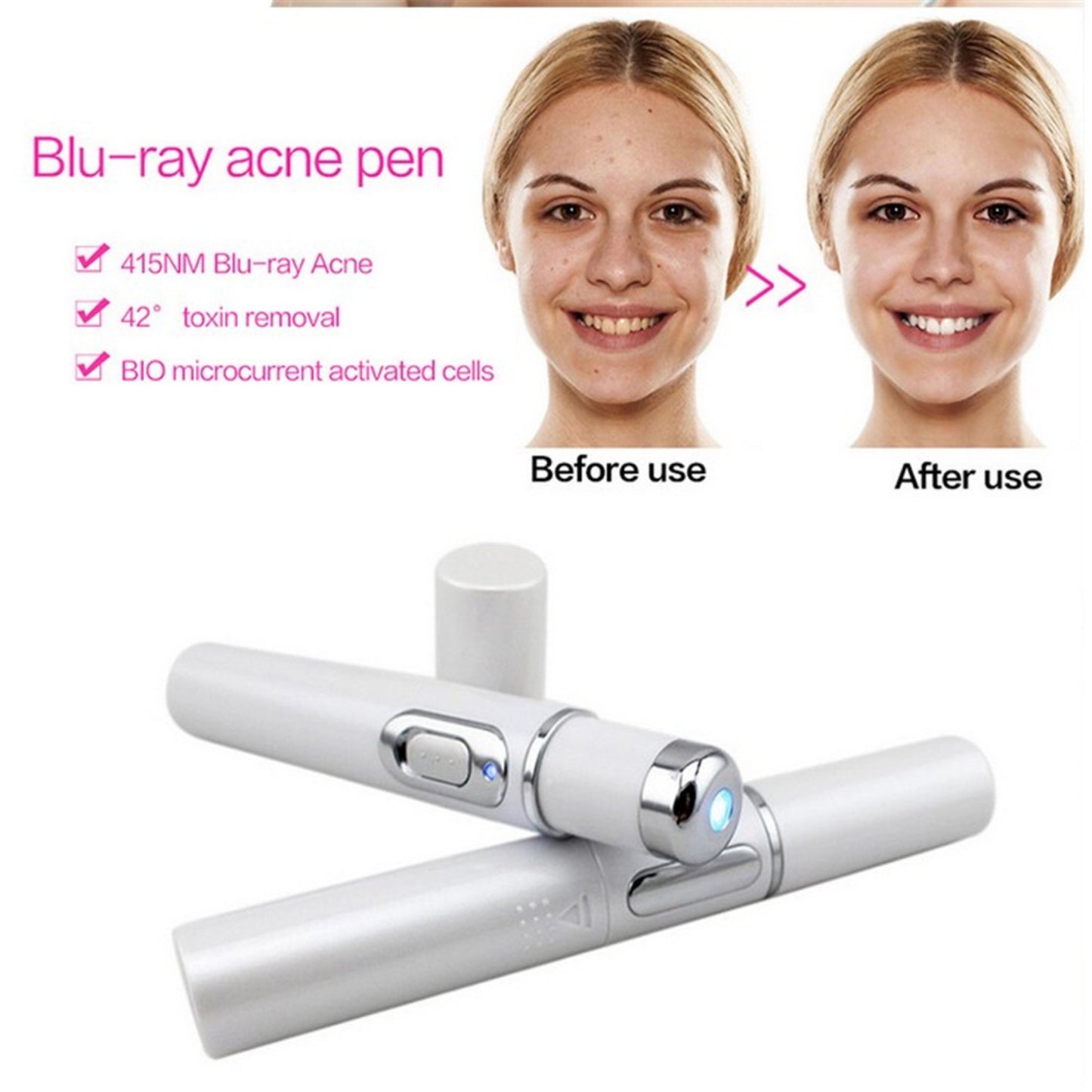 Blue Light Therapy Acne & Wrinkle Removal Pen