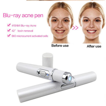 Blue Light Therapy Acne & Wrinkle Removal Pen