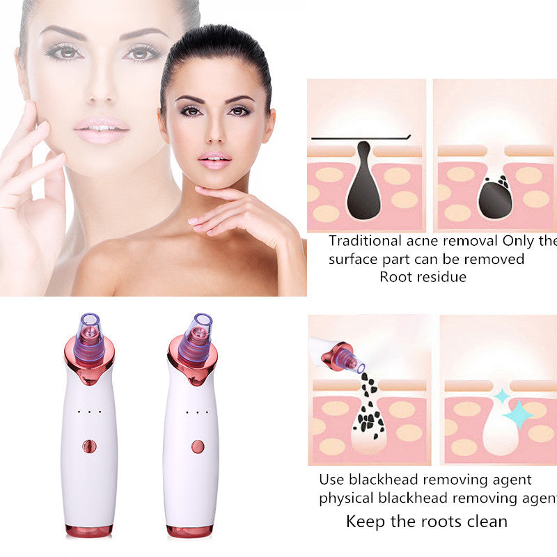 Blackhead Remover Vacuum Suction Tool for Facial Pore Cleaning