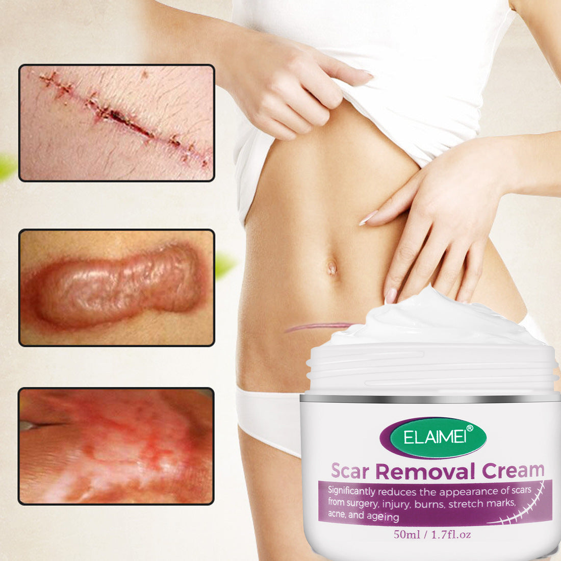 Skin Rebound Scarless Cream Scar Removal Cream Face Cream For Face Acne Scar Stretch Marks Skin Repair Face Cream