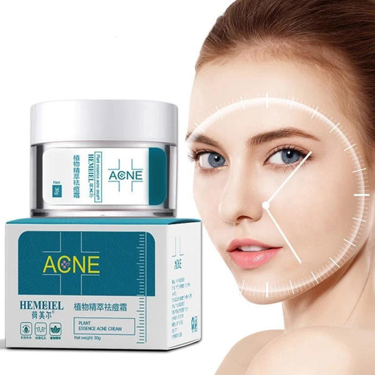 Acne Cream – Powerful Treatment for Clear, Blemish-Free Skin