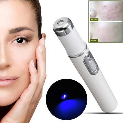 Blue Light Therapy Acne & Wrinkle Removal Pen