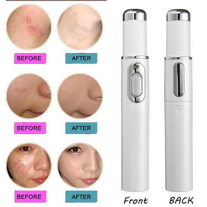 Blue Light Therapy Acne & Wrinkle Removal Pen